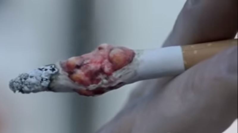 Sigaret met tumor